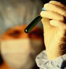 Как сделать тест на паразитов