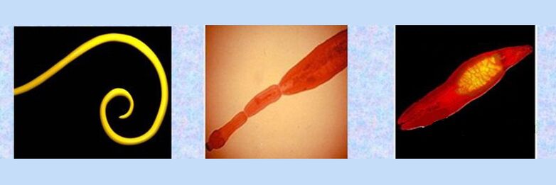 Виды паразитов человека – круглые черви, ленточные черви, сосальщики. 